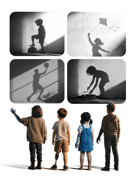 Children with prosthetic limbs and their shadow dreams - playing football, flying kites, gardening